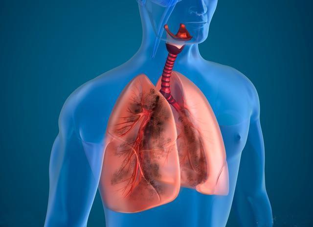 肺炎-呼吸训练器-基层肺功能-脑卒中-心血管病-中风-脑梗-慢阻肺-哮喘-呼吸肌-排痰-肺功能检测仪-赛客