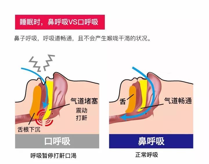 肺炎-哮喘-慢阻肺-咳嗽-咳喘-支气管炎-肺功能检测仪-呼吸训练器-心脏病-心血管疾病-口呼吸-整容-呼吸峰流速仪